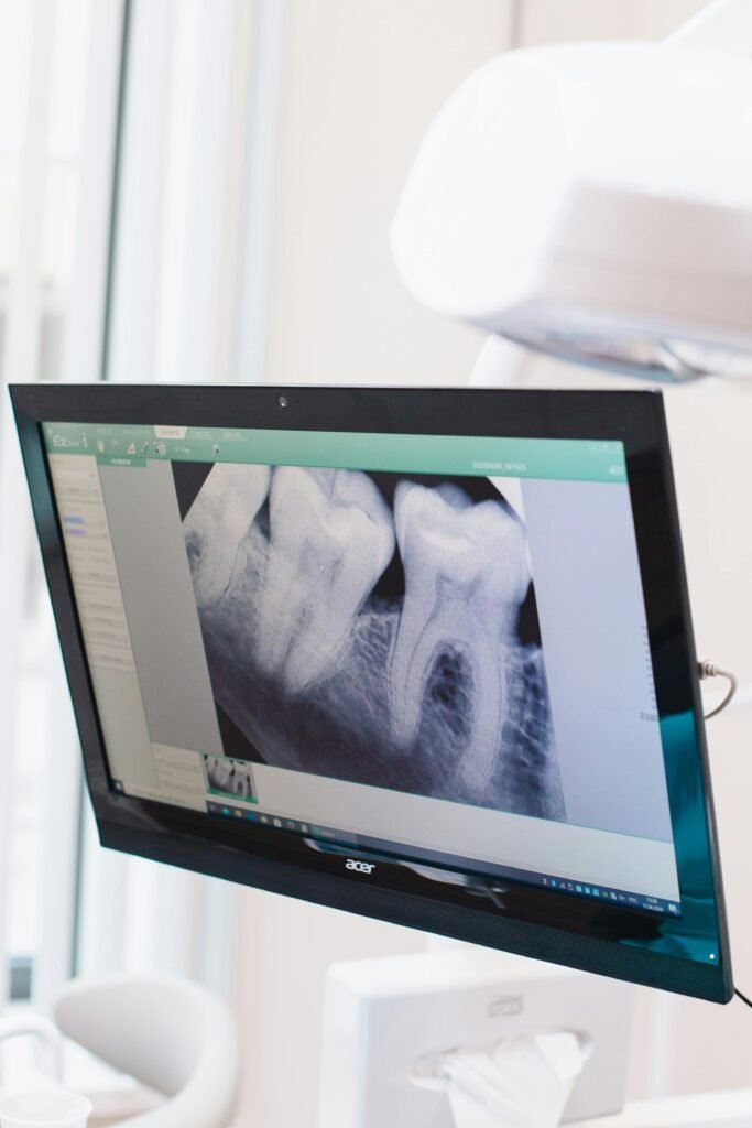 Close-up of a dental x-ray displayed on a monitor in a dental office.
